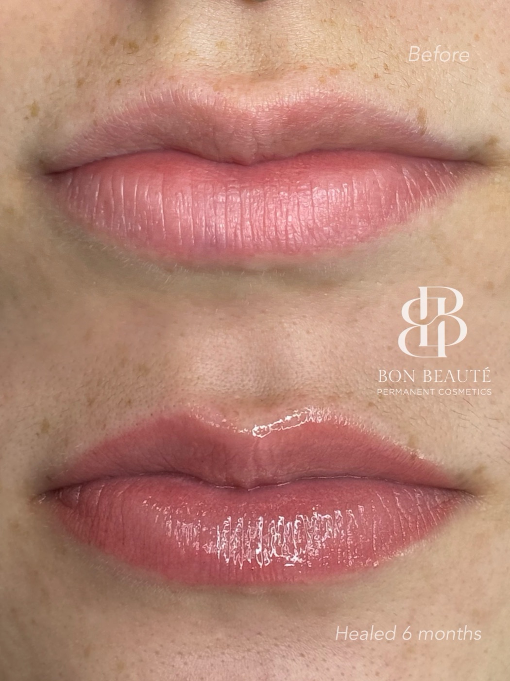 Lip blush before and healed at six months
