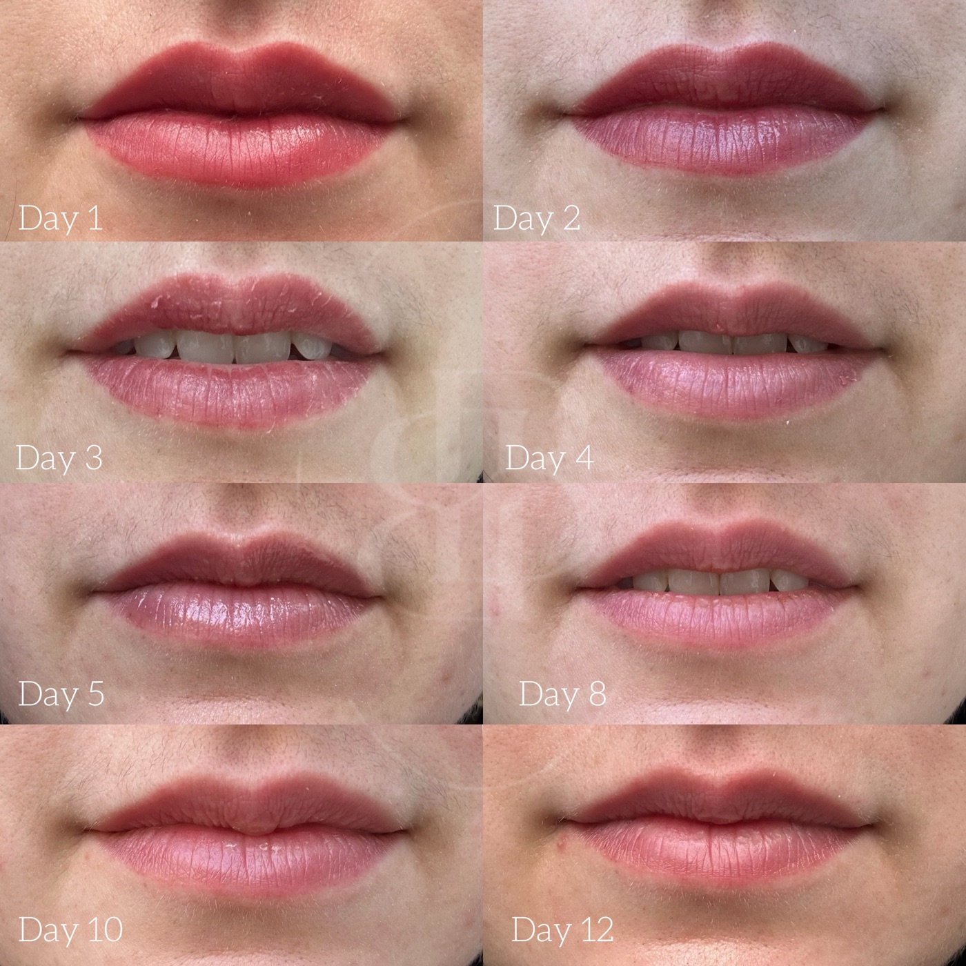 Lip blush healing day 1 through 12