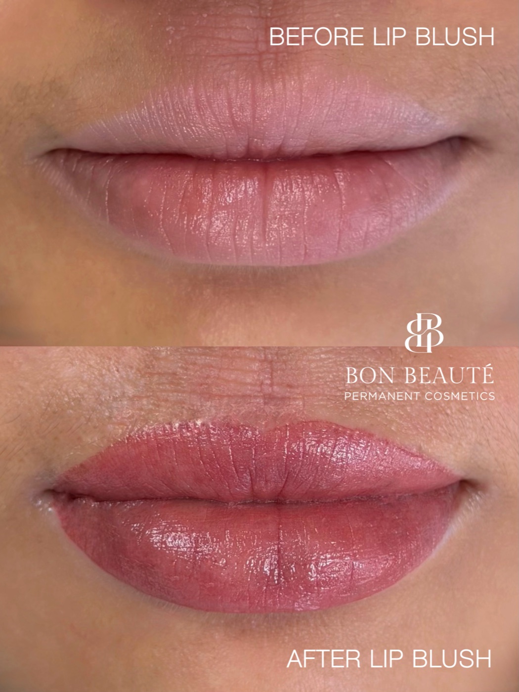 Lip blush, one year healed