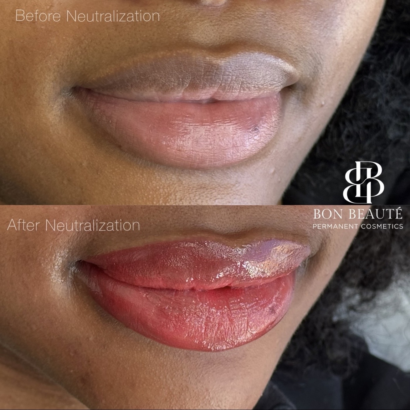 Lip neutralization before and after — balanced rosy result